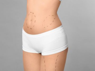 Tratamiento liposucción Sevilla