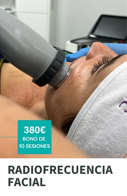 radiofrecuencia facial