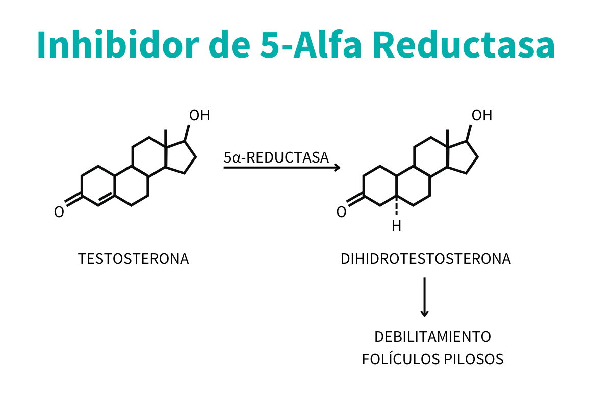 dutasteride es un inhibidor de 5-alfa reductasa