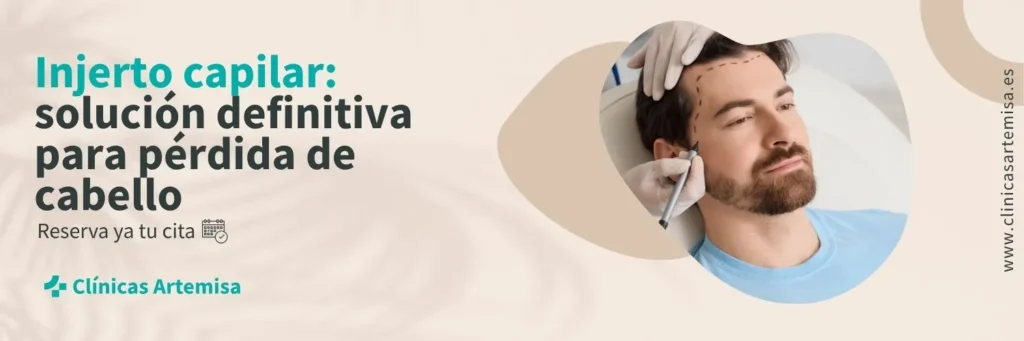 precio injerto capilar