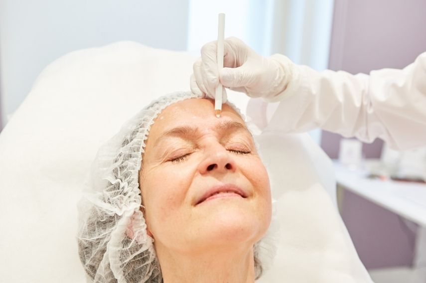 tratamiento de lifting facial
