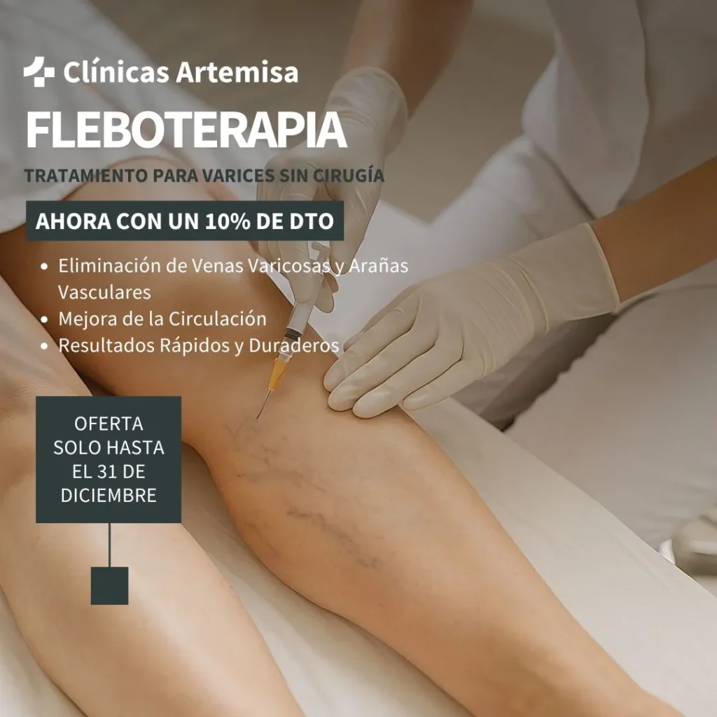 tratamiento de varices con fleboterapia regenerativa