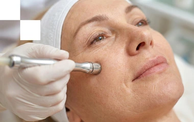 tratamientos esteticos para eventos