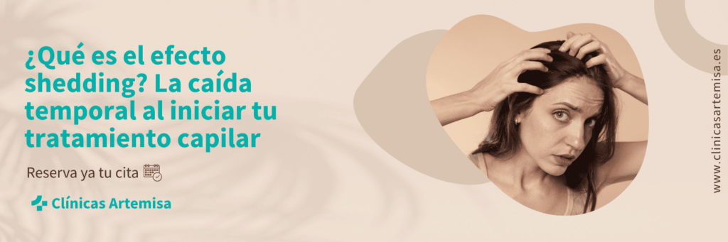 caida temporal de cabello