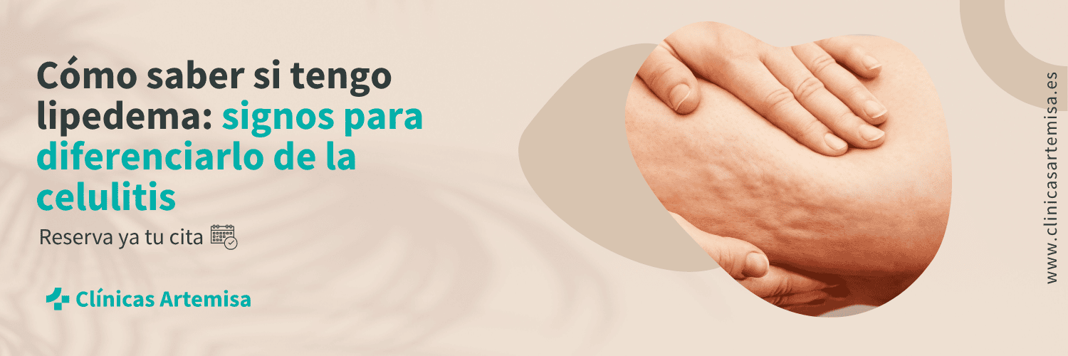 consulta para lipedema