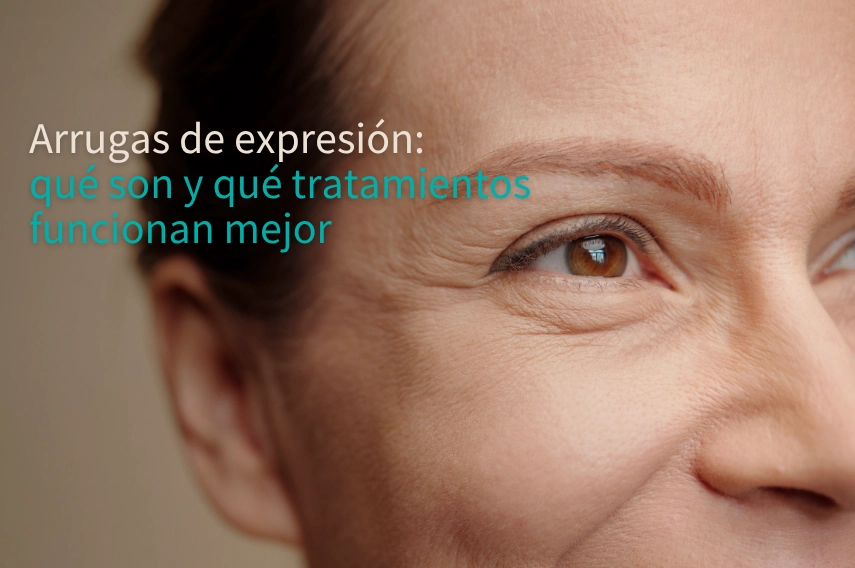 tratamiento para arrugas de expresión (1)