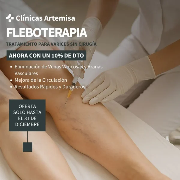 tratamiento de varices con fleboterapia regenerativa