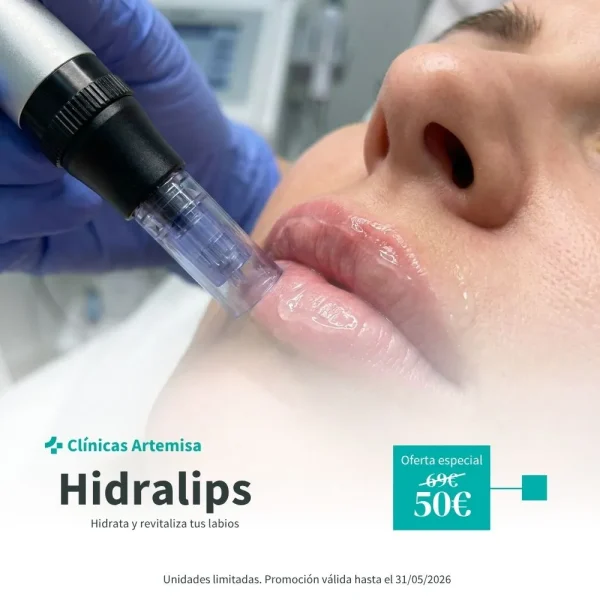 Hidralips sevilla